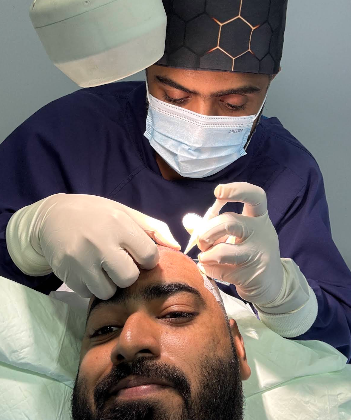 Inshaf Jaz DHI hair transplant