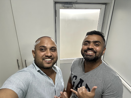 Chandika Dammanthota DHI hair transplant