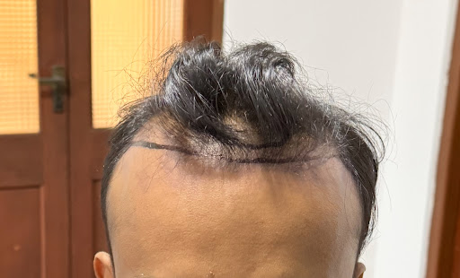 Madura Gunawardana before