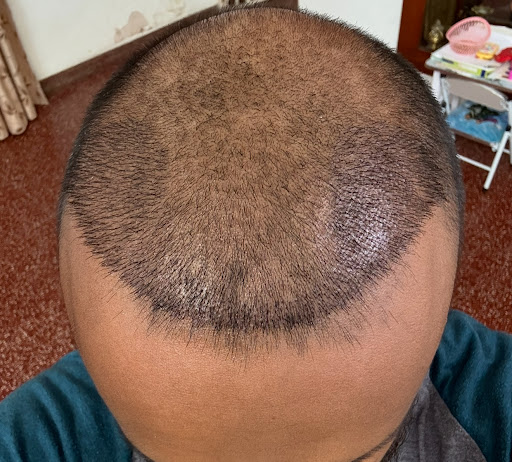 Madura Gunawardana progress
