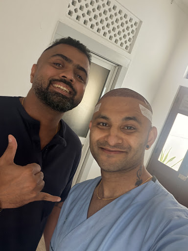 Naveen Chhetri DHI hair transplant